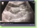 2006.10.04 echo1.jpg